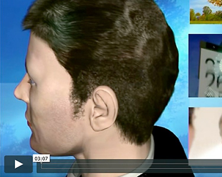 3D Animation medizin demoreel